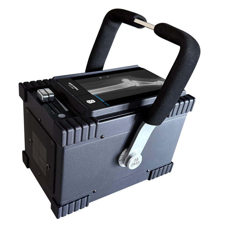 ConnectRAY 90 kVp/20mA Battery Operated Portable Generator