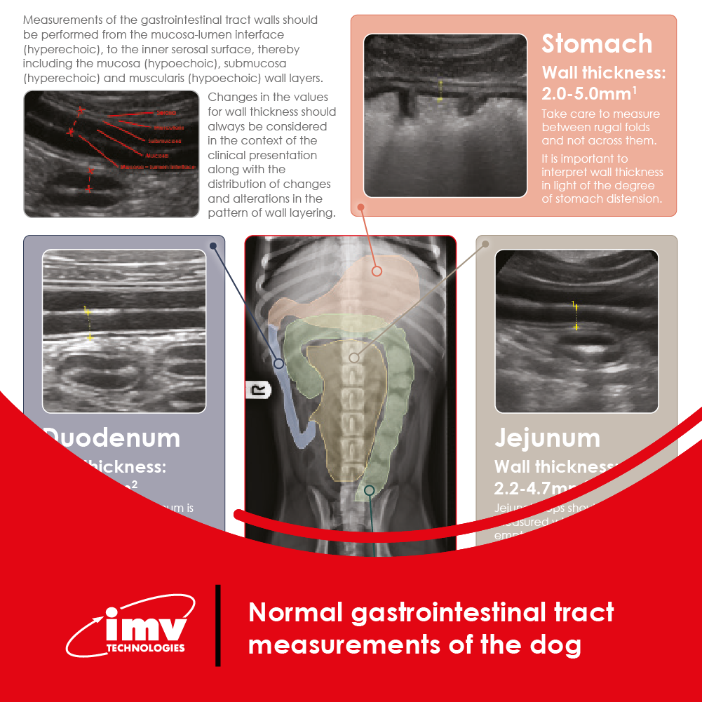 Free Download: Abdominal measurements poster