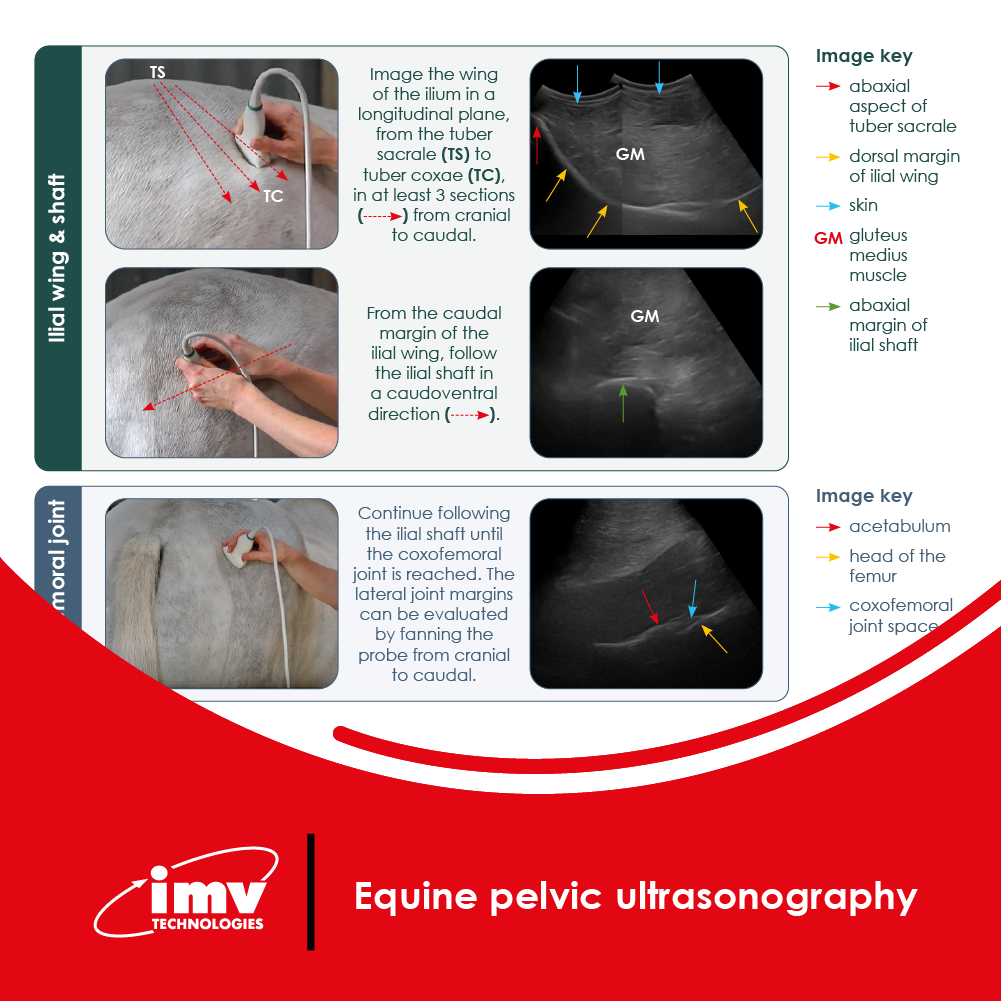 Free Download: Pelvic Ultrasonography Poster