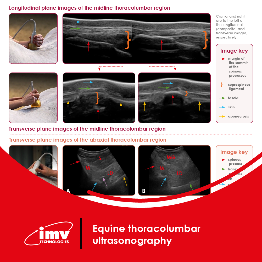 Free Download: Thoracolumbar Ultrasonography Poster