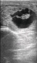 Equine Fetus approx 26 days