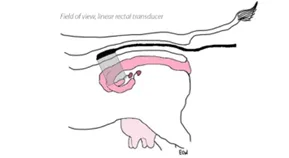 Field of view linear rectal transducer