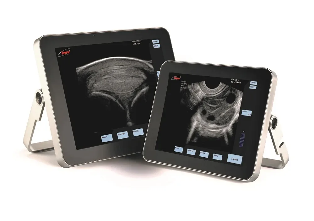 Free software upgrade for your ExaPad and ExaPad Mini (v1.05)